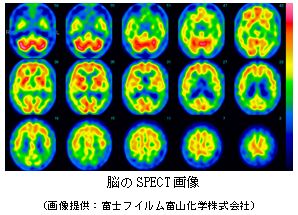 spect SPECT-CT検査 - 総合病院 土浦協同病院